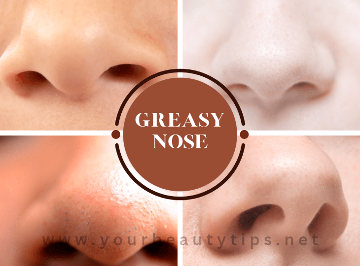 Greasy Nose