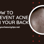 The image appears to show a person's back with small red bumps and blemishes, commonly associated with acne. The person's skin seems to have a shiny appearance, suggesting that it may be oily or prone to excessive sweating. To prevent acne on your back, there are several steps you can take. Firstly, it's important to keep your skin clean and free from sweat and oils, which can clog pores and lead to breakouts. Regularly showering with a gentle, fragrance-free body wash and using a loofah or exfoliating scrub to gently remove dead skin cells can help to unclog pores and prevent acne. Wearing loose-fitting clothing made from breathable fabrics such as cotton can also help to prevent acne on your back. Tight-fitting clothing can trap sweat and oils against your skin, creating the ideal environment for acne-causing bacteria to thrive. Another important step in preventing back acne is to avoid using heavy or greasy skincare products, which can clog pores and exacerbate breakouts. Instead, opt for lightweight, non-comedogenic products that won't clog your pores. Finally, maintaining a healthy lifestyle with a balanced diet, regular exercise, and adequate sleep can also help to prevent acne on your back by reducing stress levels and promoting overall skin health.